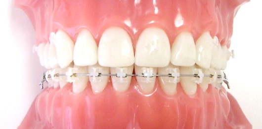 ハーフリンガル