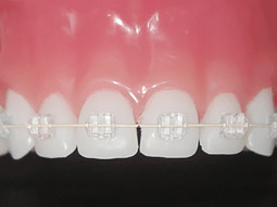 目立ちにくい装置