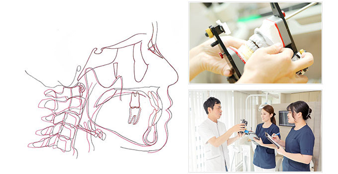 レントゲン撮影、セファロ分析、模型診断