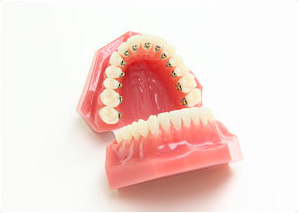 「舌側矯正」が得意です